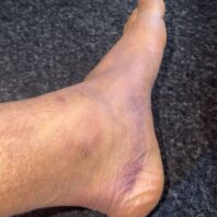 ApuestasBono - Equipo de ApuestasBono Francia